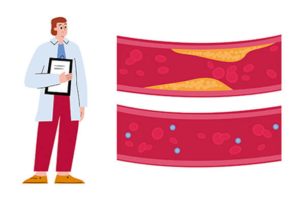 高血脂怎麼辦？—中醫帶你全方位調理身體